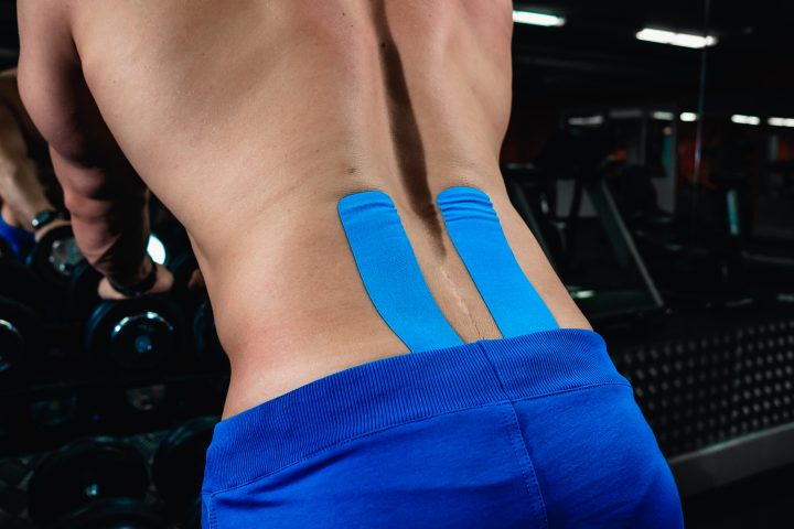 Кинезиологическое тейпирование