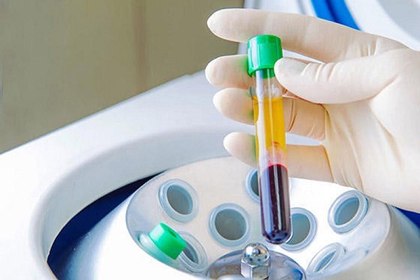 Плазмолифтинг