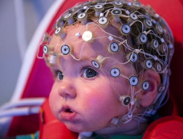 Электроэнцефалограмма в Челябинске